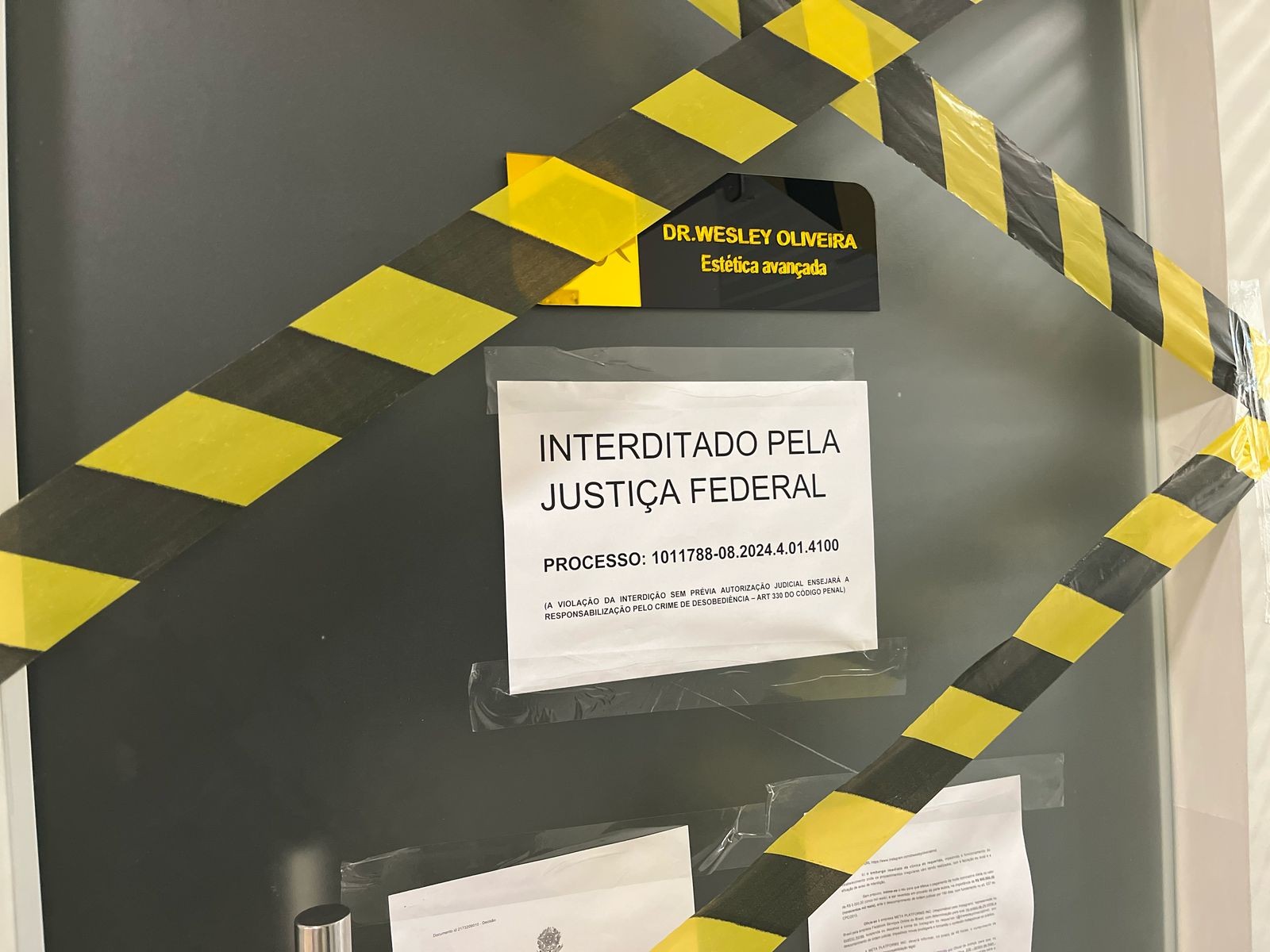 Biomédico do AC tem clínica interditada pela Justiça Federal por fazer harmonização íntima sem autorização
